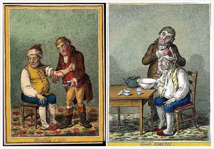 开颅手术脑洞大开,欧洲古代放血灌肠疗法