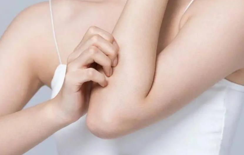 中医药膏治小儿湿疹,中药外敷治湿疹越敷越严重