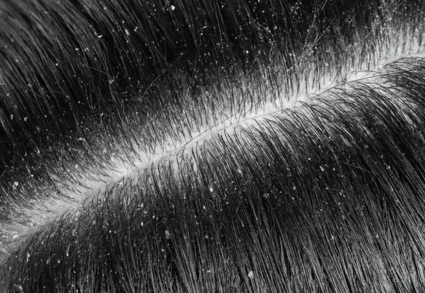 用艾叶熬水洗头3个月有什么变化,艾叶煮水洗头六个月后身体变化