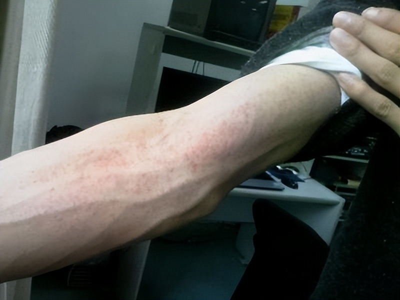 西红柿尽量少吃最好不吃有道理吗,老中医为何建议西红柿尽量少吃