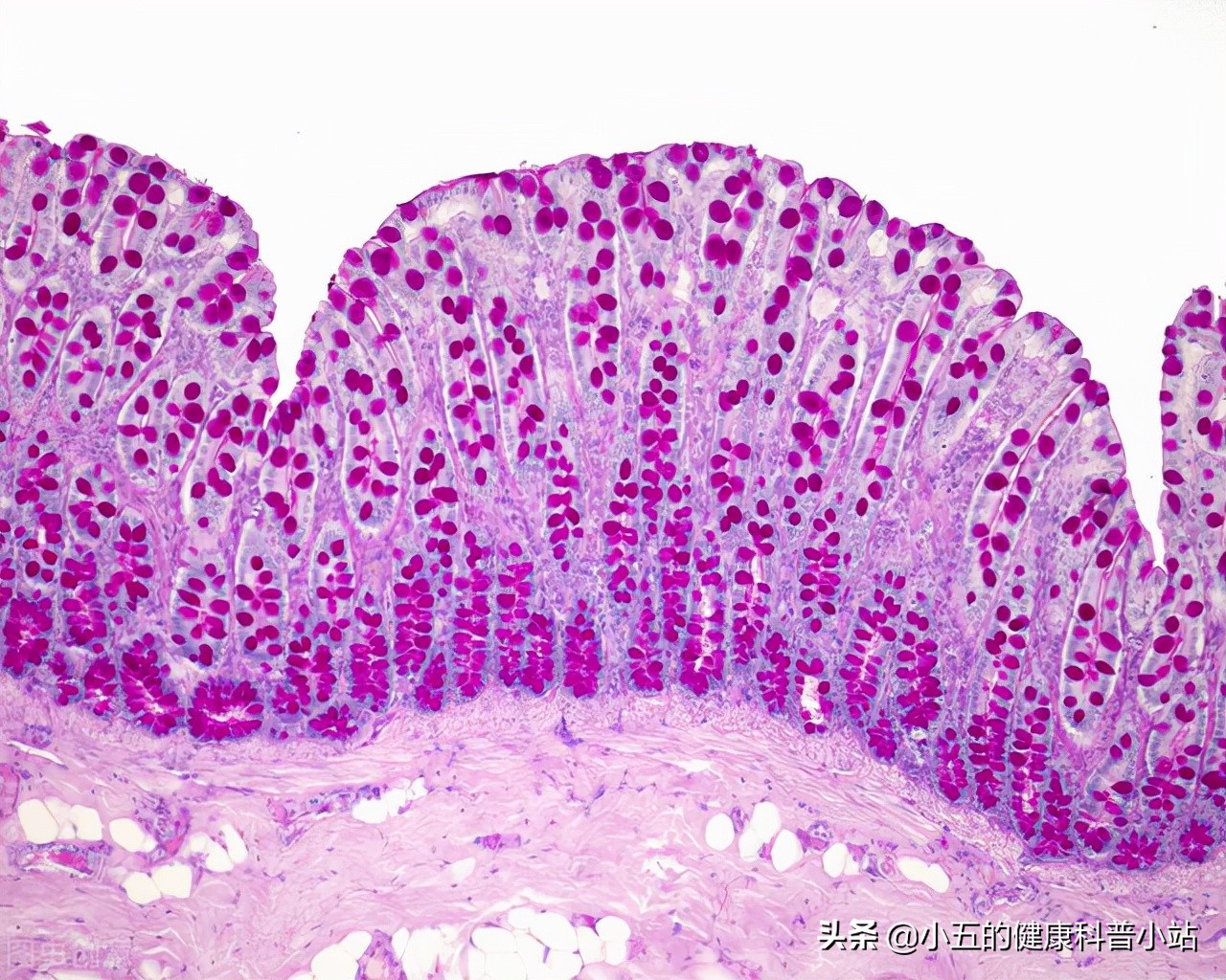 麻仁软胶囊是治疗老年便秘的常用药,能长期服用吗?一文说清