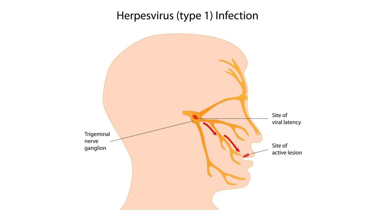 怎么知道自己上火了都有哪些症状,以为是上火其实是癌症