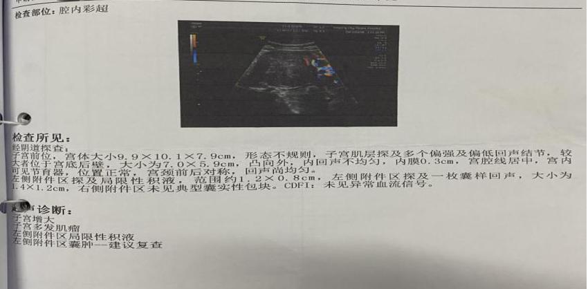 子宫肌瘤每次月经来之前腹痛,子宫肌瘤连续性出血