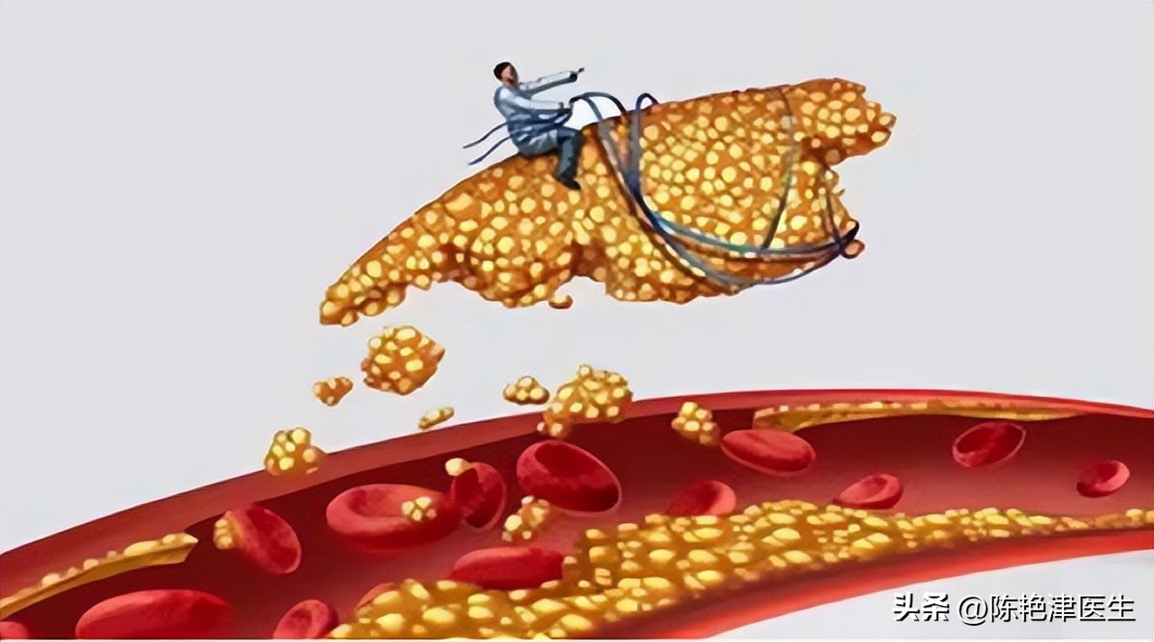 体检甘油三酯偏高是怎么解决,体检显示甘油三酯高是怎么回事