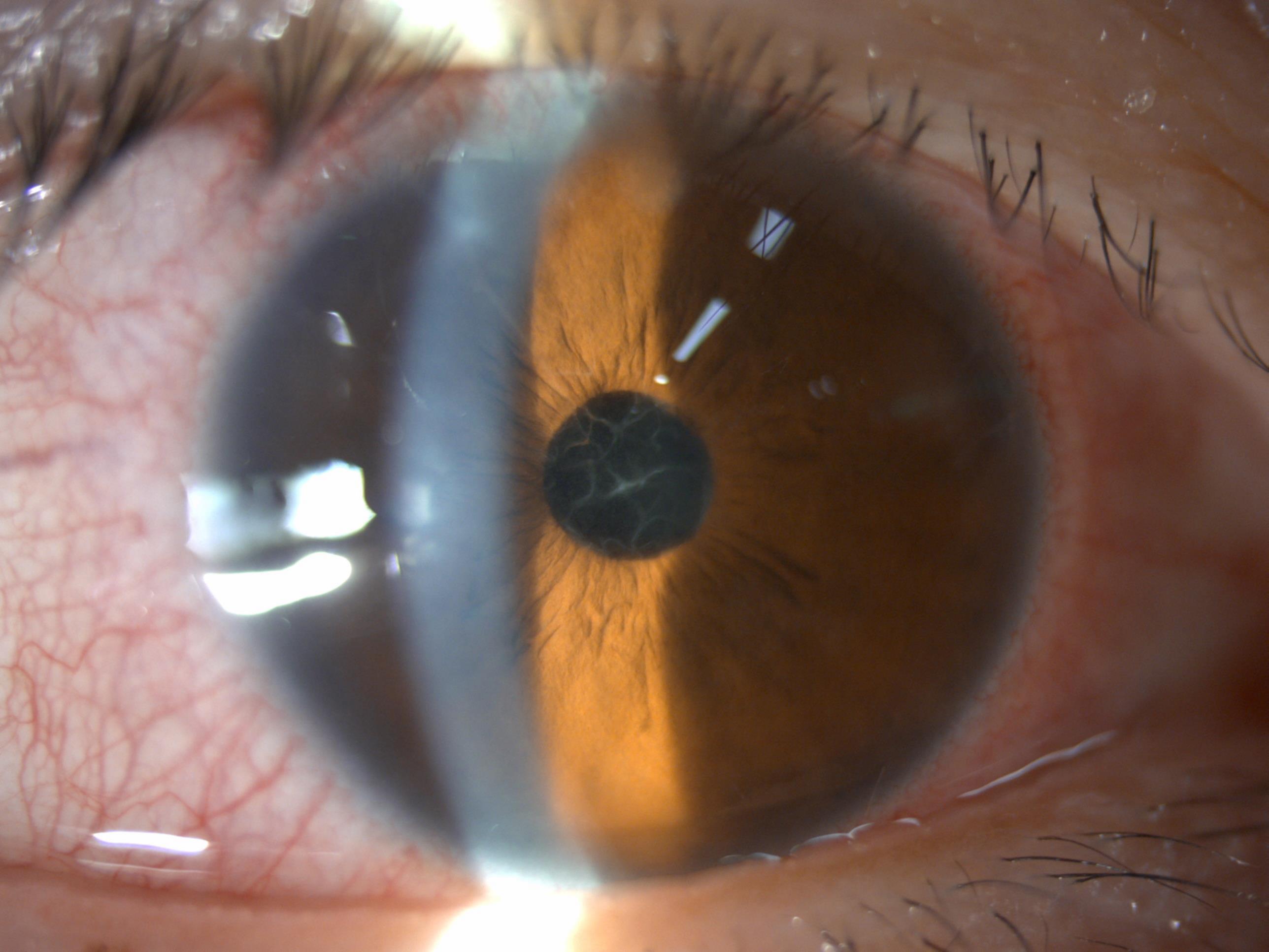 我和来自美国求医的Jason过了一个虚惊一场的父亲节