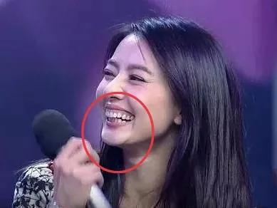 明明是绝顶大美女，却被牙齿拉胯，这15位女星苦不堪言