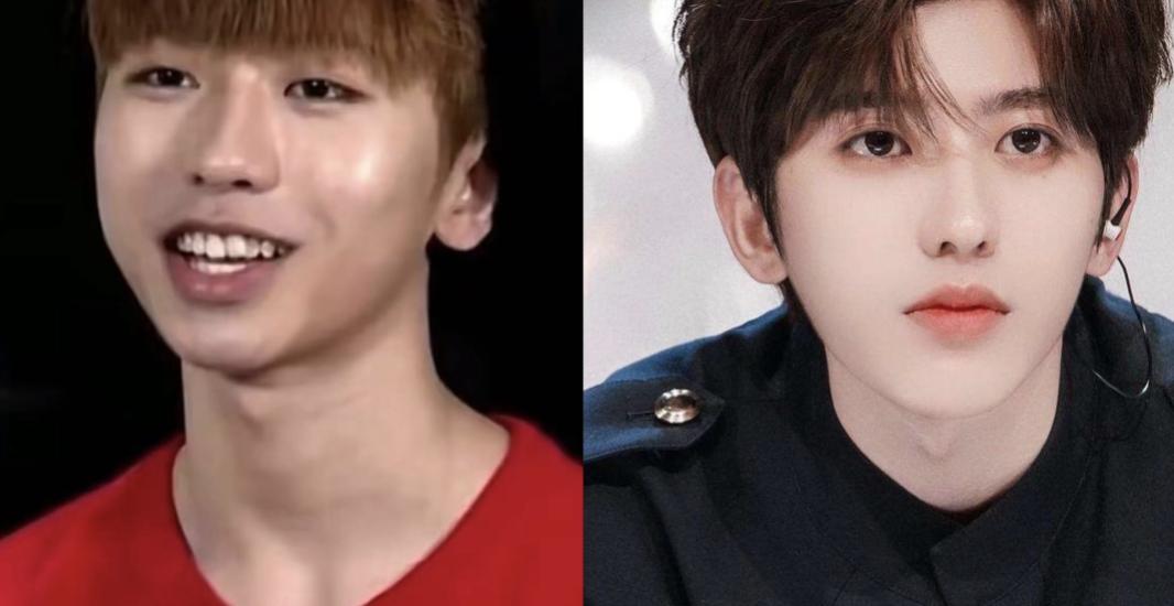 假下巴对决！谁的能戳死人，谁的下一秒就飞出去，谁的越整越残？