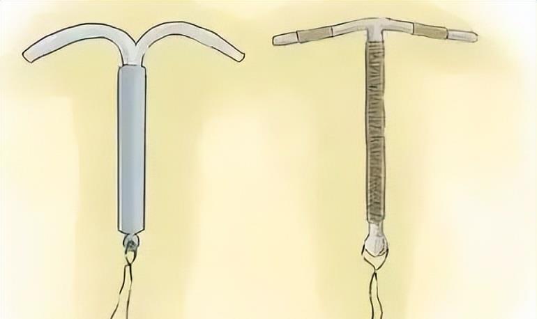 男子结扎1年后妻子竟怀孕医院被判赔偿1万4究竟怎样避孕才靠谱？