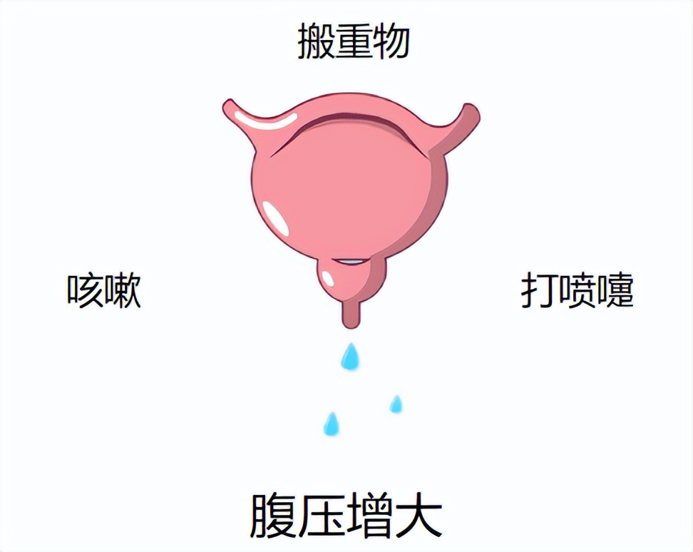 「掌健识」告别产后漏尿的正确方式