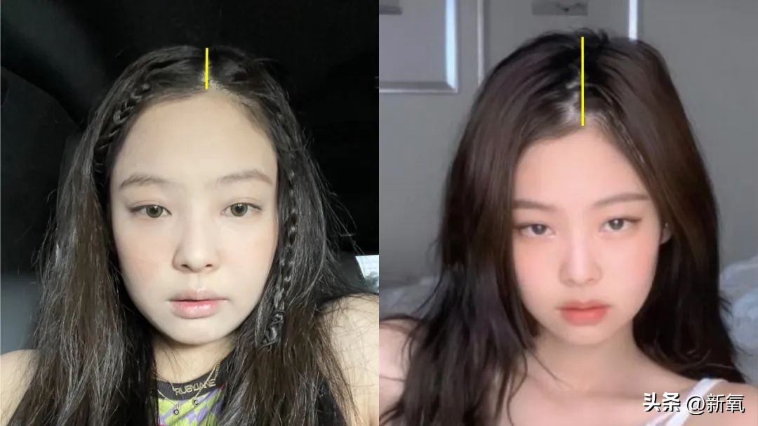 发际线高低怎么样才合适,发际线高低有没有影响运气