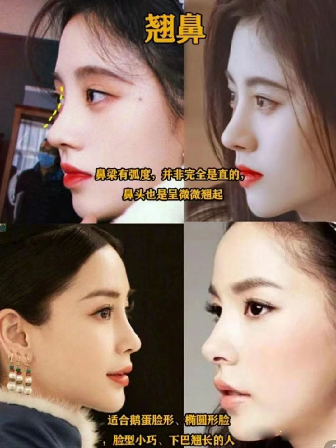 显老显凶怎么办,鼻子最丑三大鼻型怎么改变