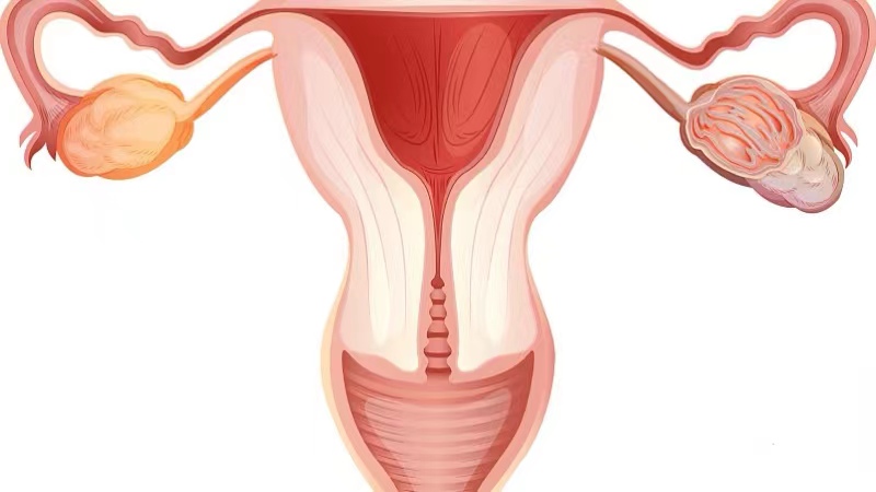 什么叫巨阴症能生育吗,巨阴症是什么病能治愈吗