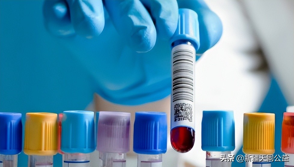 艾滋病检测技术发展史,万孚4代艾滋13天试纸准确度