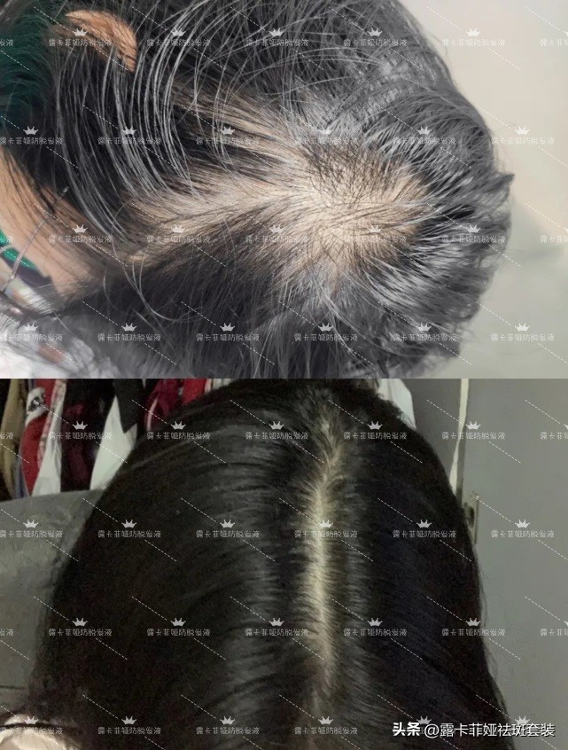 什么牌子洗发水生发防脱发,生发防脱洗发水什么牌子的最好