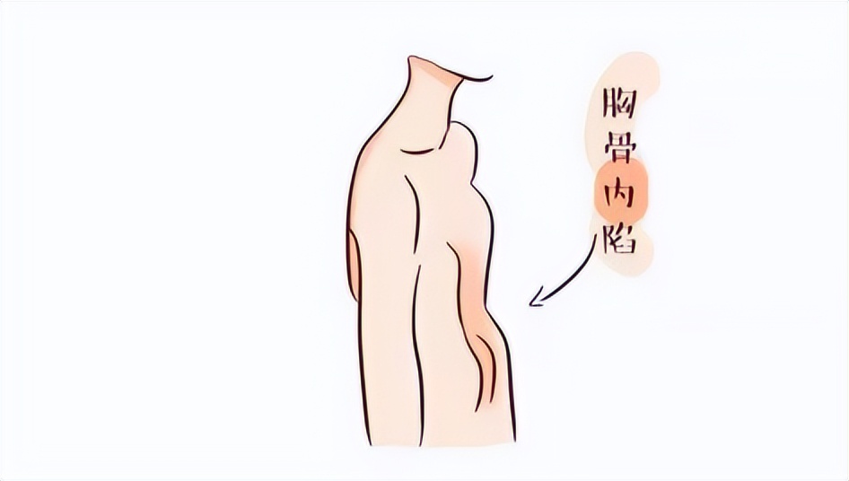 青少年如何克服社交恐惧症,暑期来临拒绝社交恐惧症