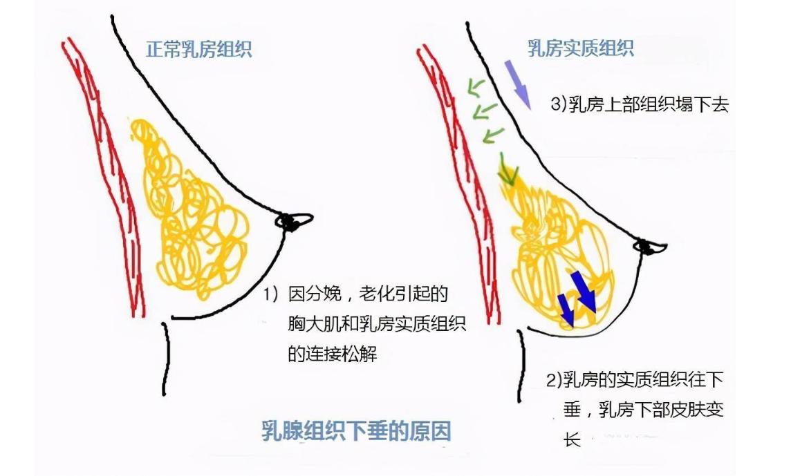医生坦言：女人生没生过娃，一眼就能看出来，这3点不同很明显！