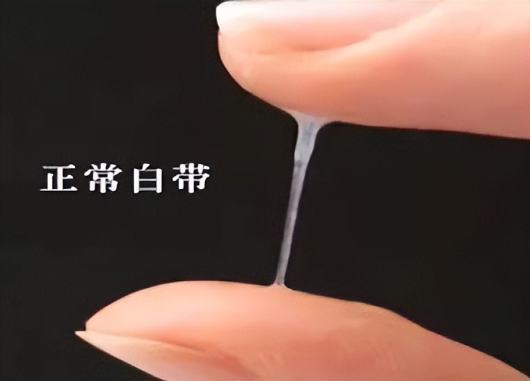 10年没治疗，子宫肌瘤长到4斤，如6个月的婴儿！手术取出109颗