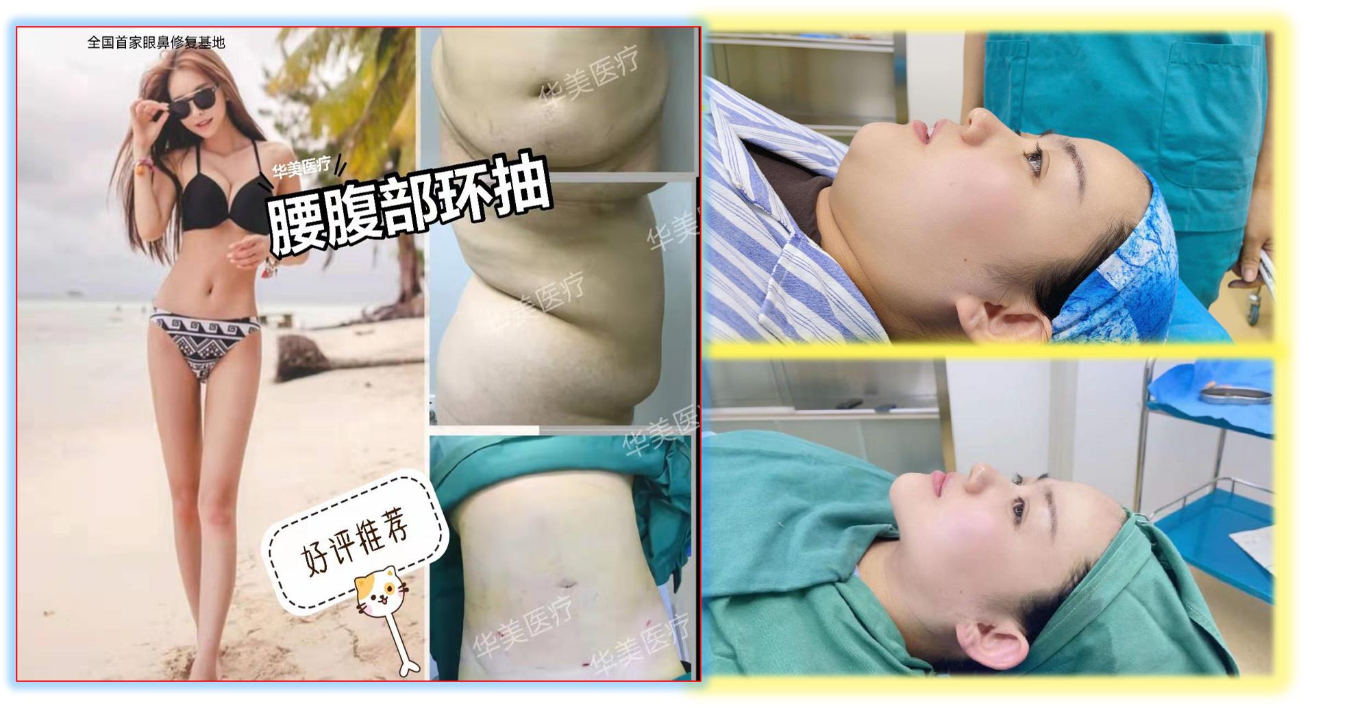 海博医美在哪里,海博医美集团