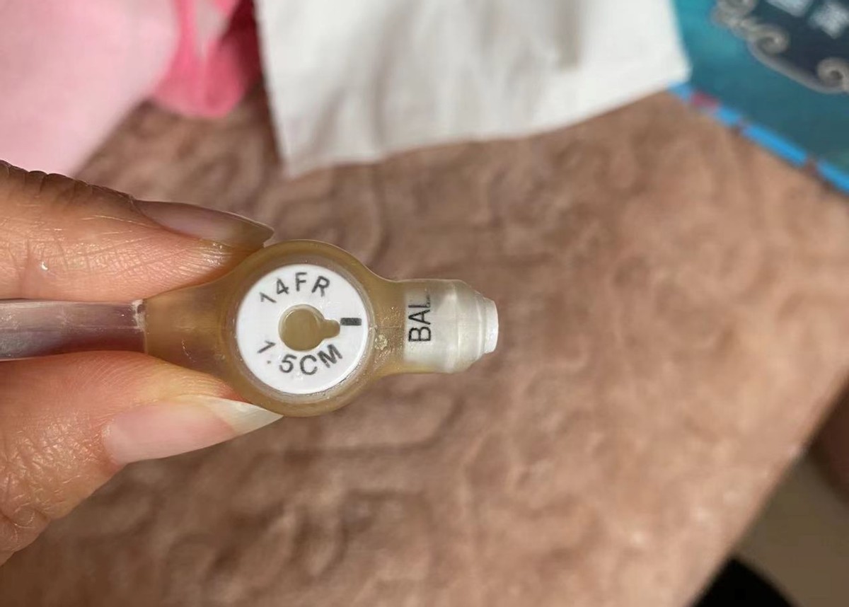 一针70万的救命药后续,70万一针的救命药能救什么