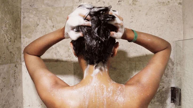 脱发跟头屑的关系,脱发和头屑的关系