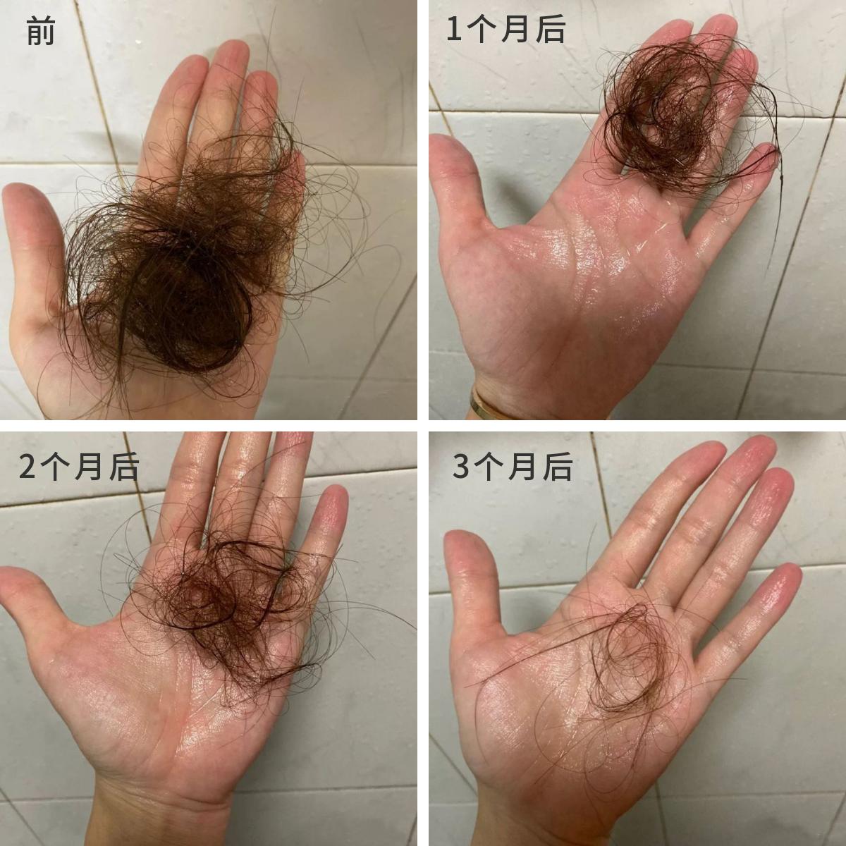 2023防脱育发洗发水大测评,2022洗发水排名防脱洗发水