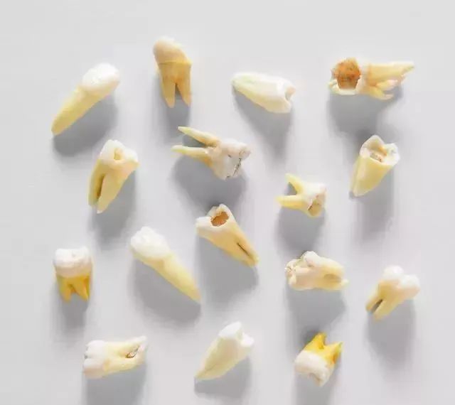 我20多岁，竟然掉牙了