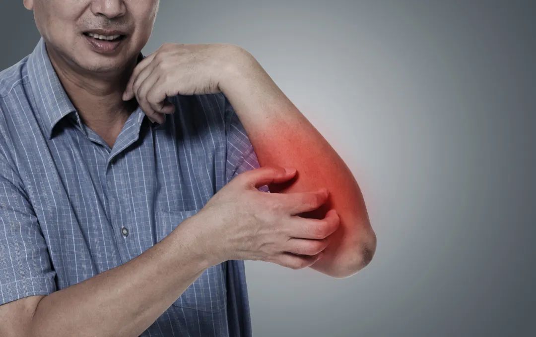 湿疹反复发作怎样做才能好得快,他克莫司软膏治疗湿疹反复发作