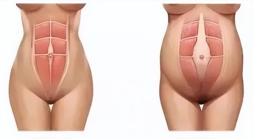 何洁减肥成功90天减重30斤,何洁产后减肥成功案例