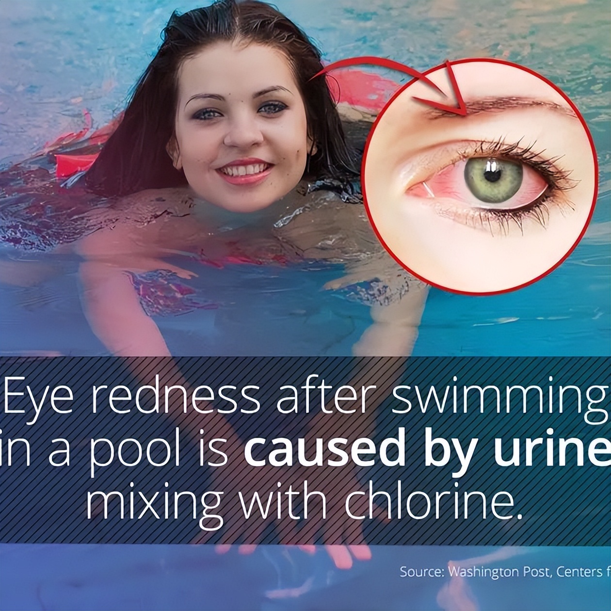 公共泳池的水有多脏,小区泳池太脏怎么办