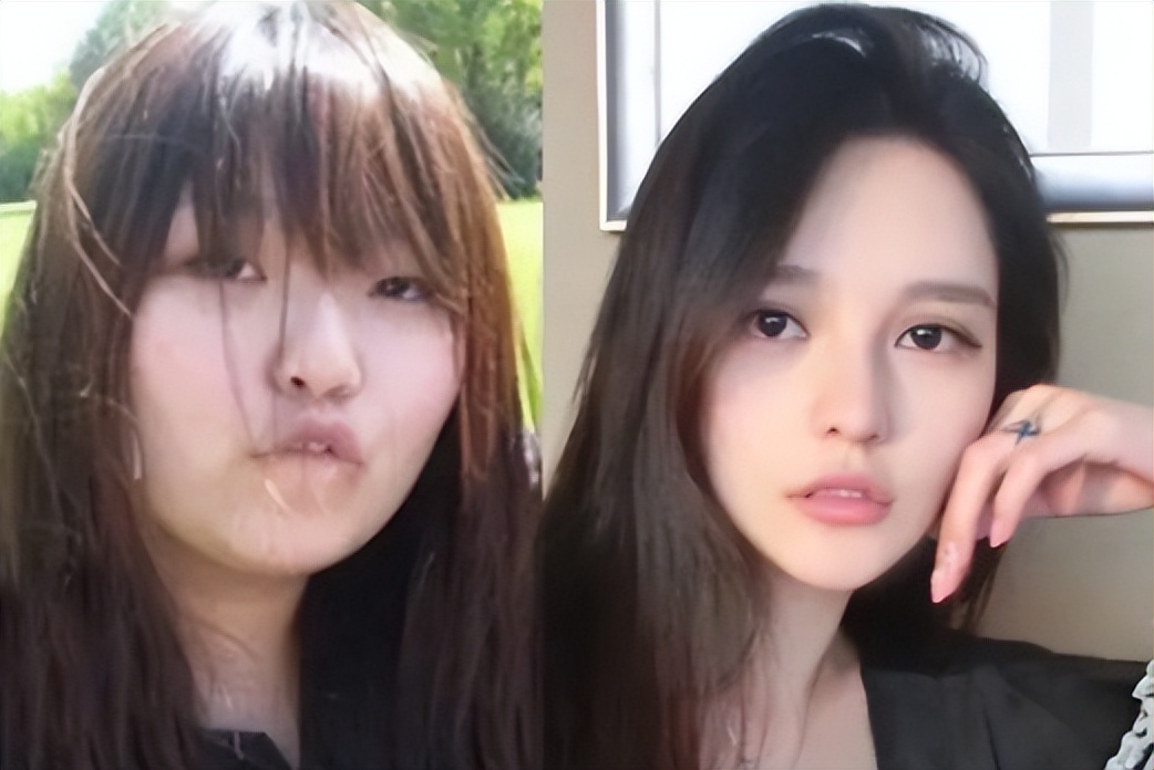 这些整容后都逆袭的女明星,盘点全网那些整容失败的女明星