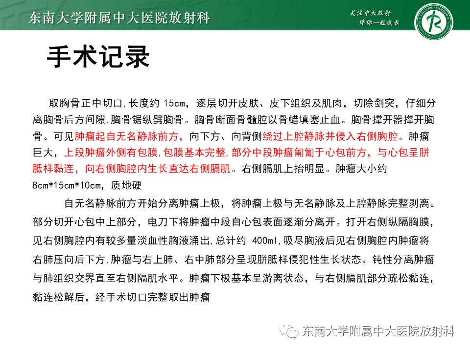 好文分享值得深思,纵隔精原细胞瘤