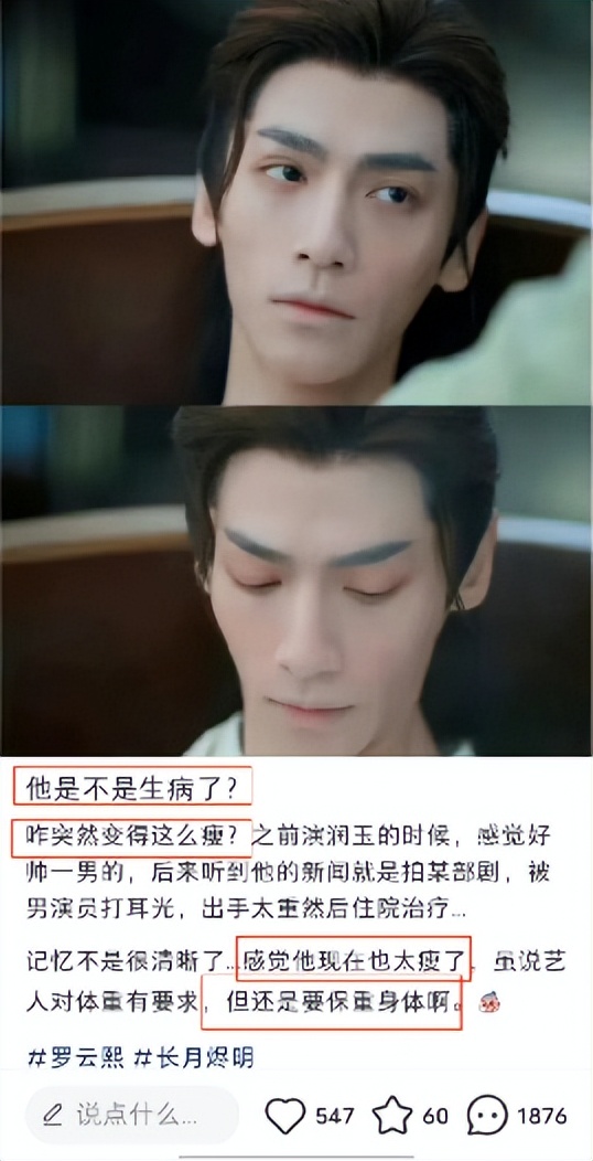 瘦到脱相的男明星罗云熙,为什么黑罗云熙瘦偏偏不黑演技