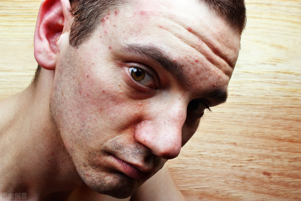 一个淡斑小妙招帮你告别黄脸婆,脸色暗黄长斑用什么祛斑的好一点