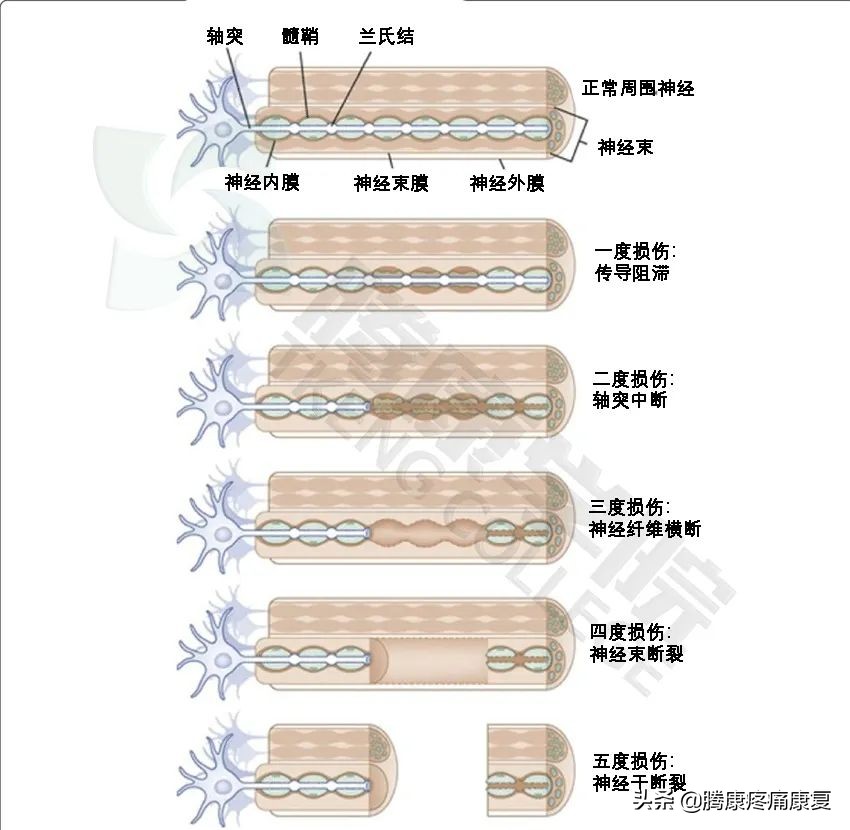 右肩与胳膊连接处疼痛是什么原因,胳膊向后抬疼痛是什么原因引起的