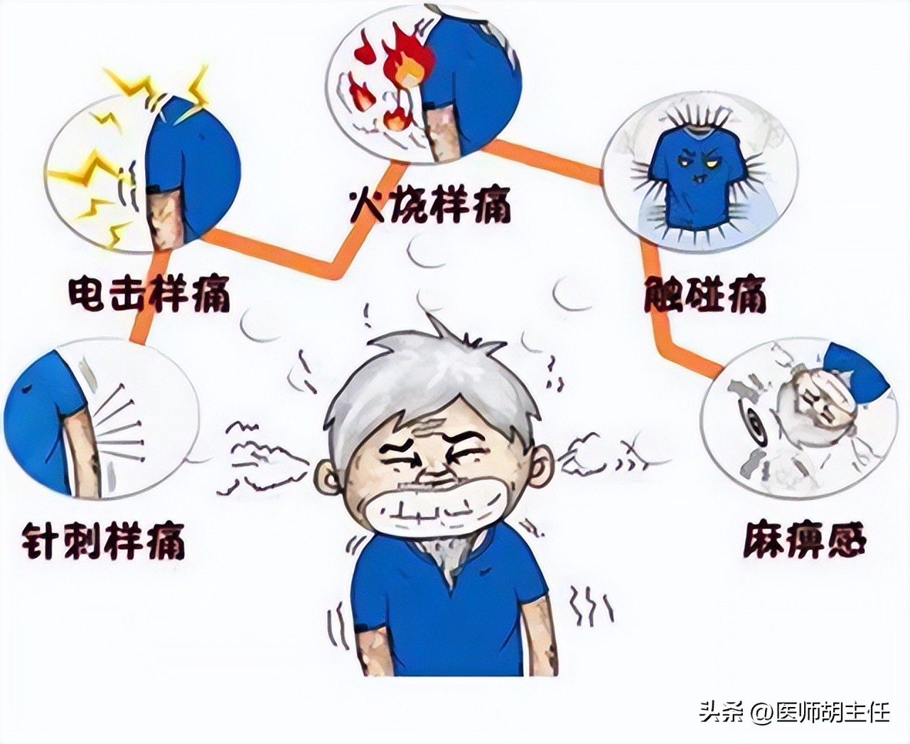 缠腰蛇疱疹干了为什么还很疼,缠腰蛇疱疹什么样