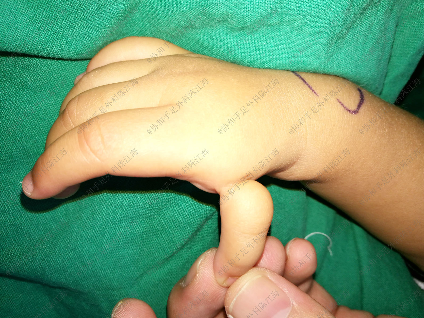 宝宝5个月右手一直动,宝宝5个月了大拇指还在手里面