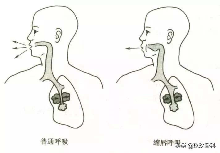 三招改善脊柱,脊柱侧弯纠正三个动作