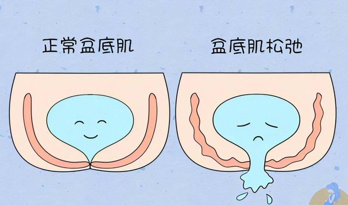 年龄增大宫颈口为什么会松弛,女人宫颈松弛是怎么回事