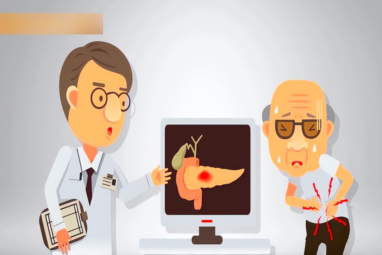 得了胰腺癌一般能活几年,得了胰腺癌能活多久