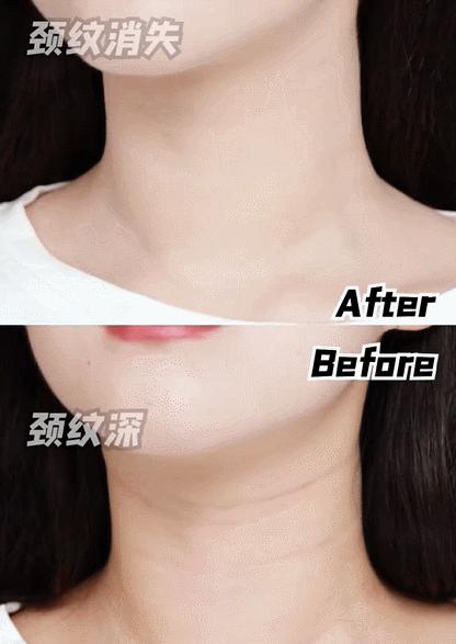 1条颈纹=显老10岁，可怕的颈纹还有救吗？