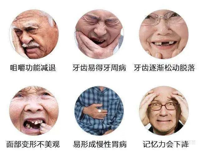 什么材质的假牙最好最耐用,十大顶级假牙