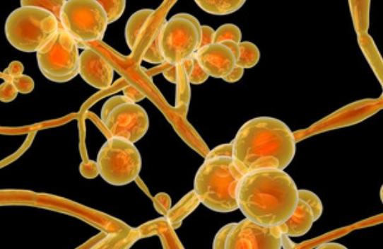 念珠菌真菌感染会引起尿频尿急吗,念珠菌真菌是什么