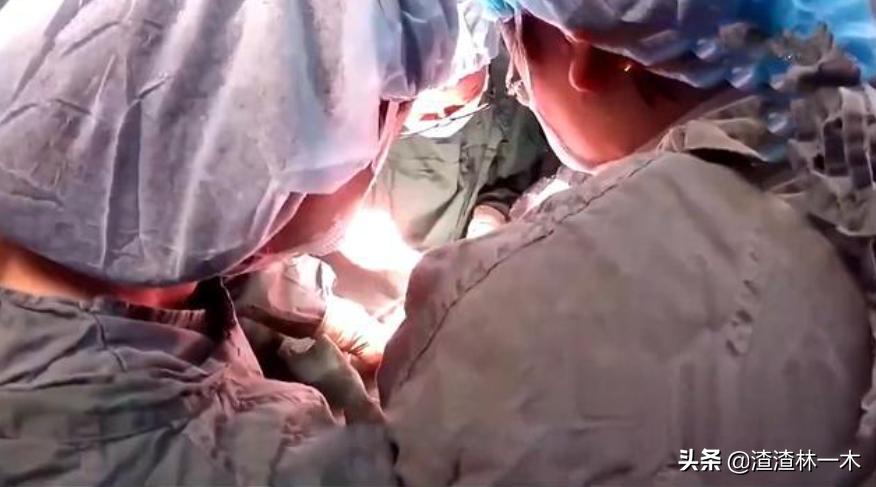 320斤孕妇剖腹生子,38岁孕妇产下3.8斤男婴