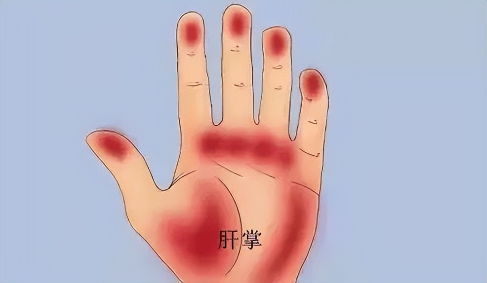 45岁后，是疾病“爆发期”，医生：若出现6个信号，早做筛查为妙