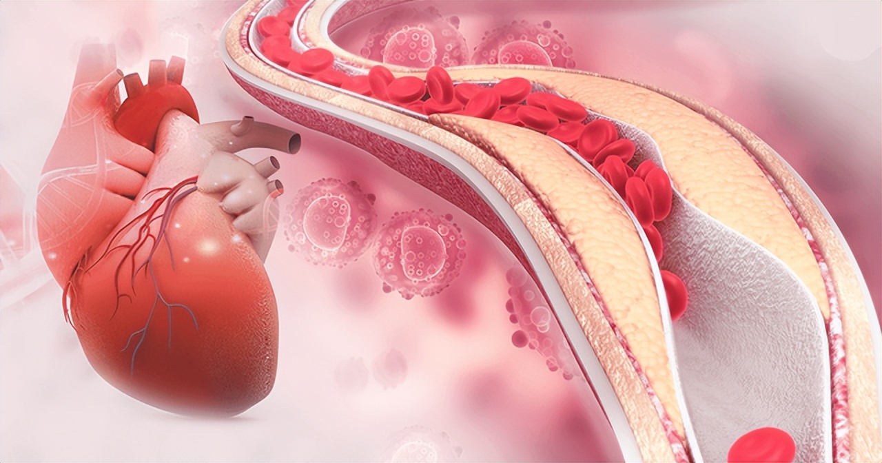 心脏供血不足良方,心脏供血不足用什么中草药调理