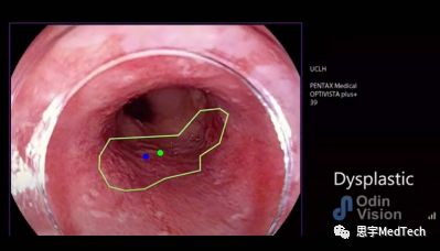奥林巴斯显微镜被哪里收购了,奥林巴斯2999