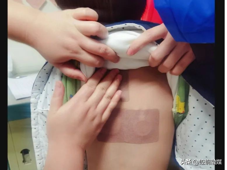 中医怎么治过敏性鼻炎流清涕不止,过敏性鼻炎眼睛痒的中医治疗方法