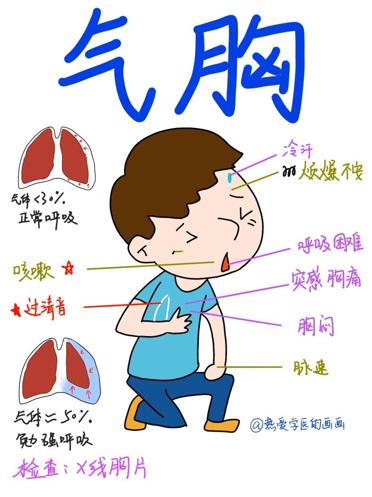 气胸插管排气后呼吸依然很痛,气胸呼吸时咯吱响