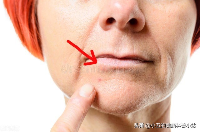 可以常吃维生素B2吗？有什么副作用吗？医生告诉你答案