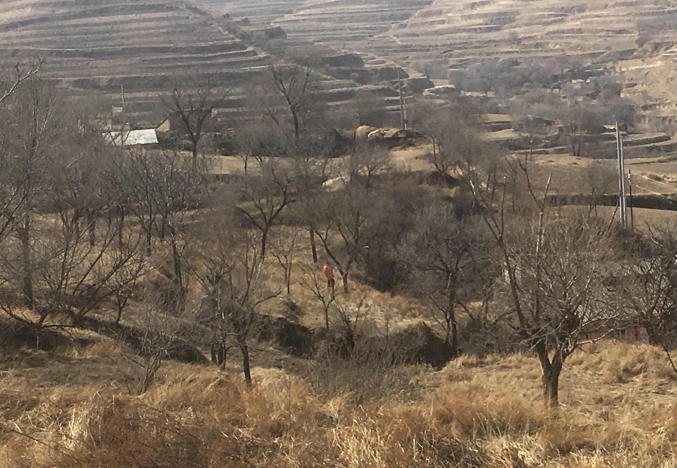 时光涟漪:天选之人，身患银屑病的美貌堂姐现实版活着